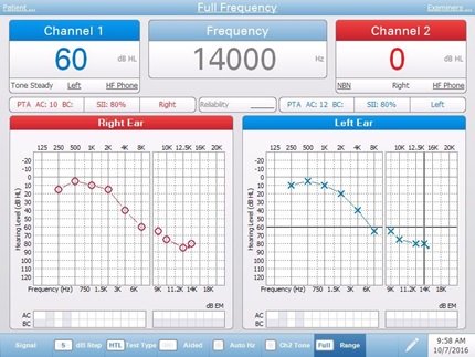 High Frequency Air Bone Conduction Testing Screen