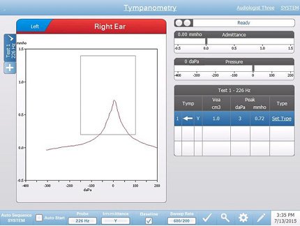 diagnostic-tympanometry-testing-screen