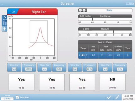 tympstar-pro-testing-screen